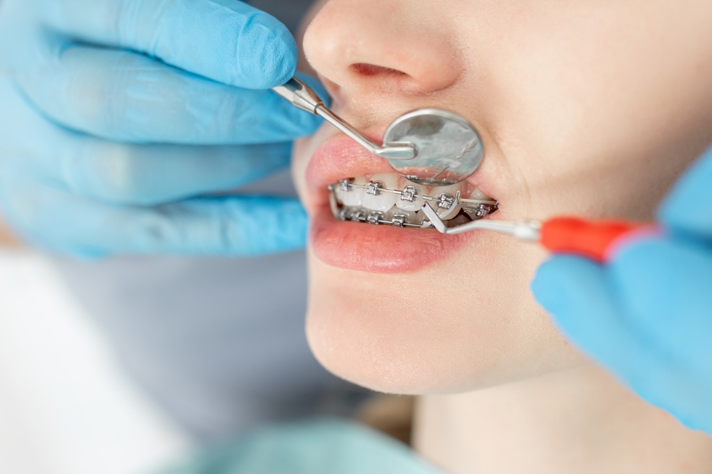 closeup-young-woman-with-braces-dental-checkup.jpg