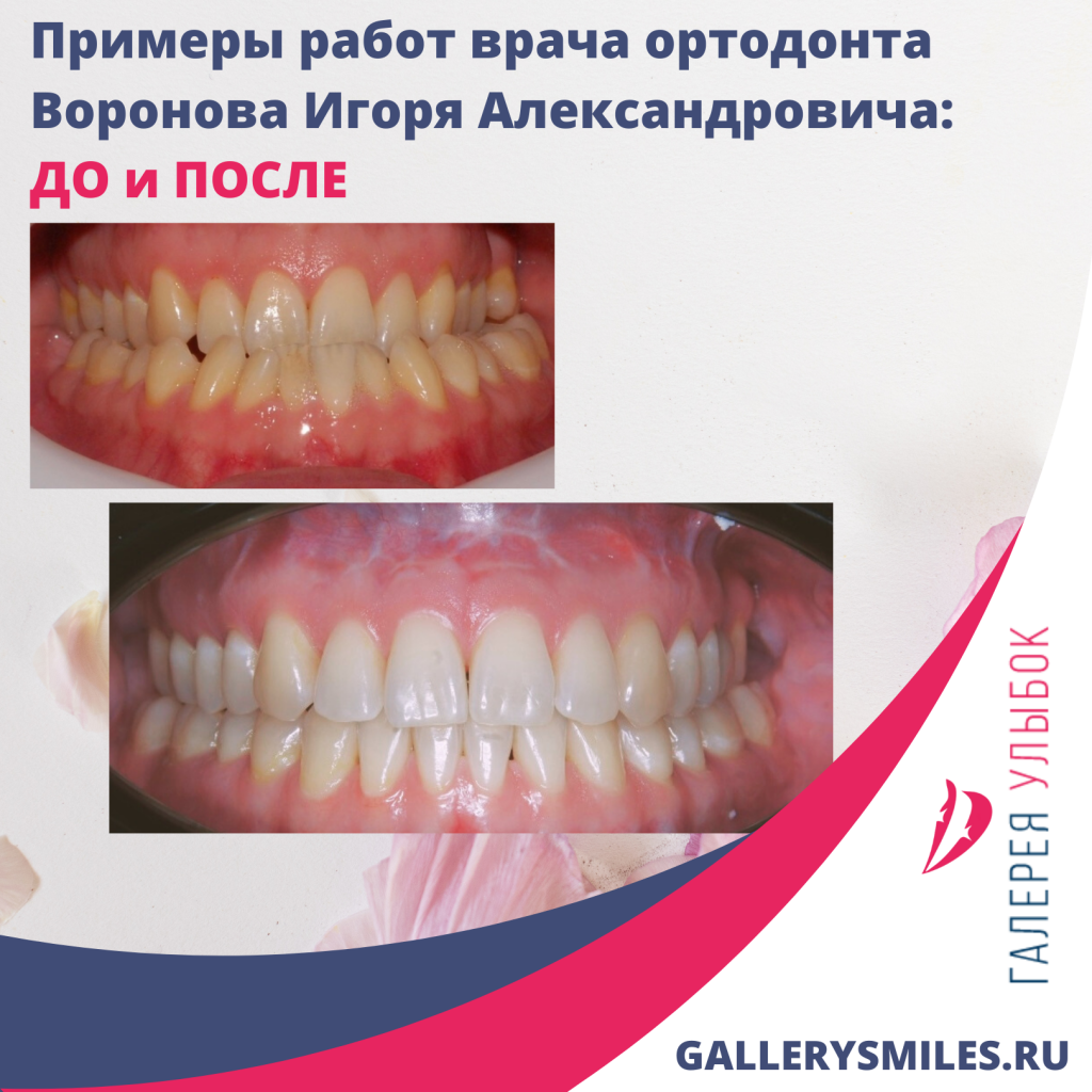Знакомим Вас с нашим стоматологом-ортодонтом - Воронов Игорь Александрович