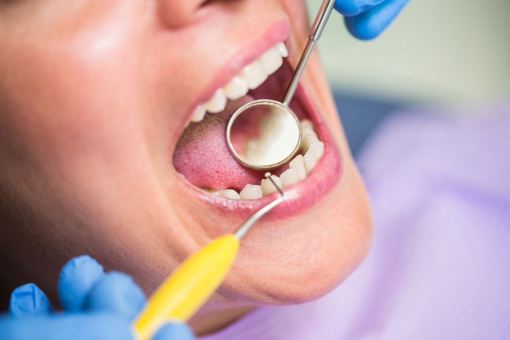dentist-examining-female-patient-teeth.jpg