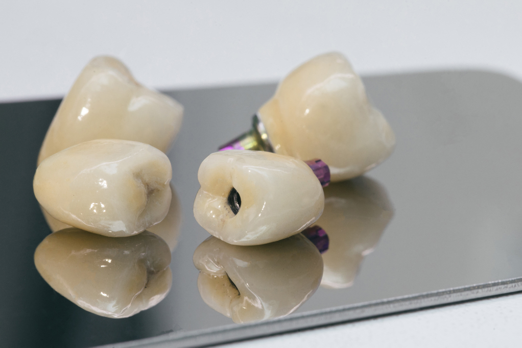 dental-health-care-dental-dentist-objects-dental-zirconium-implants.jpg
