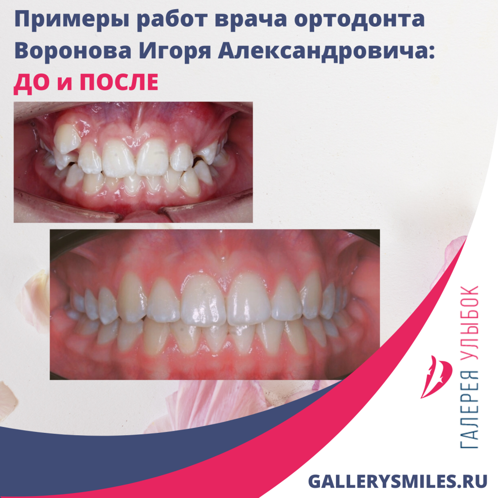 Знакомим Вас с нашим стоматологом-ортодонтом - Воронов Игорь Александрович