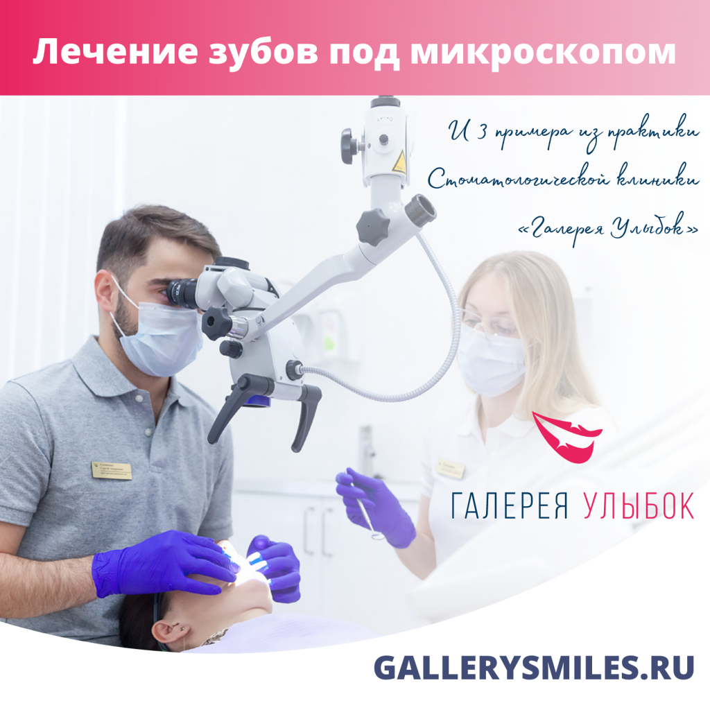 Лечение зубов под микроскопом в СПб