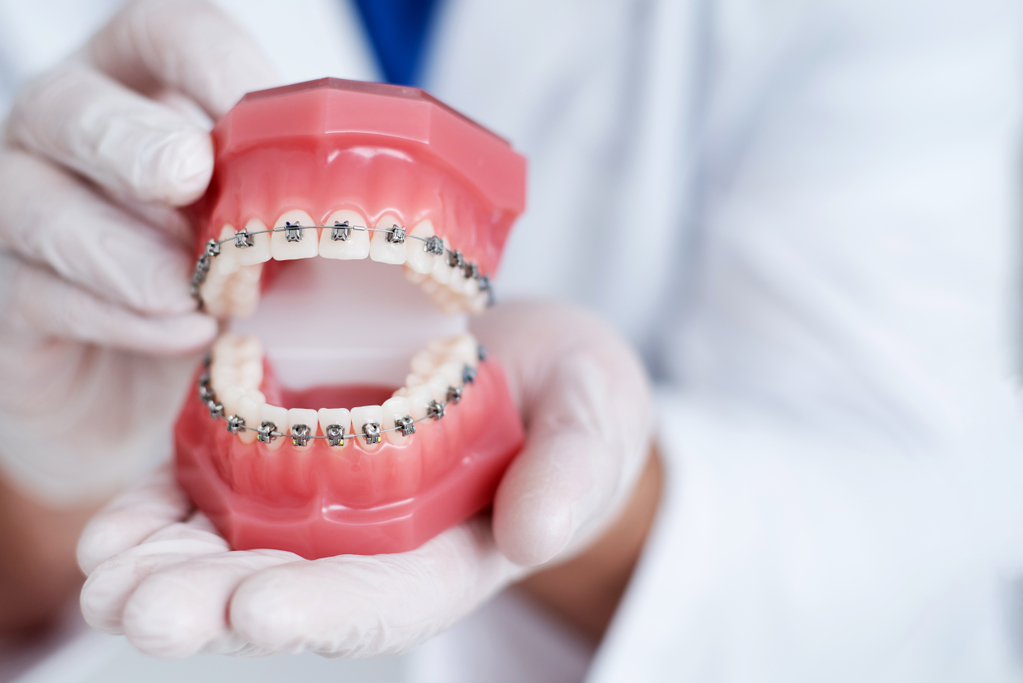 doctor-orthodontist-shows-how-system-braces-teeth-is-arranged.jpg