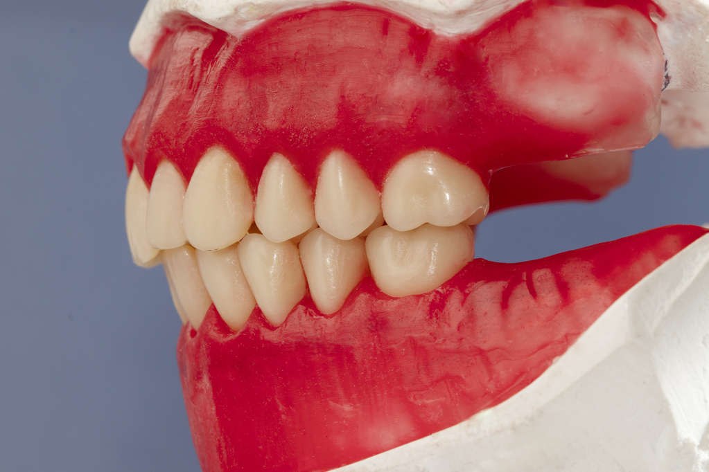 lateral-view-future-complete-dentures-teeth-arrangement-articulator.jpg